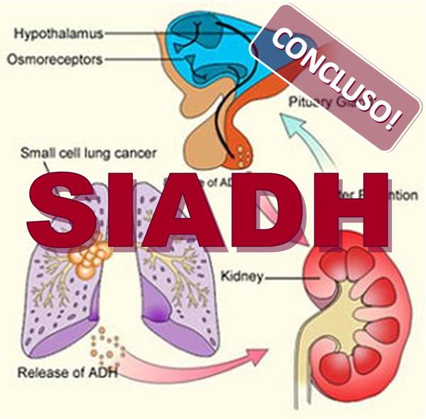 siadh